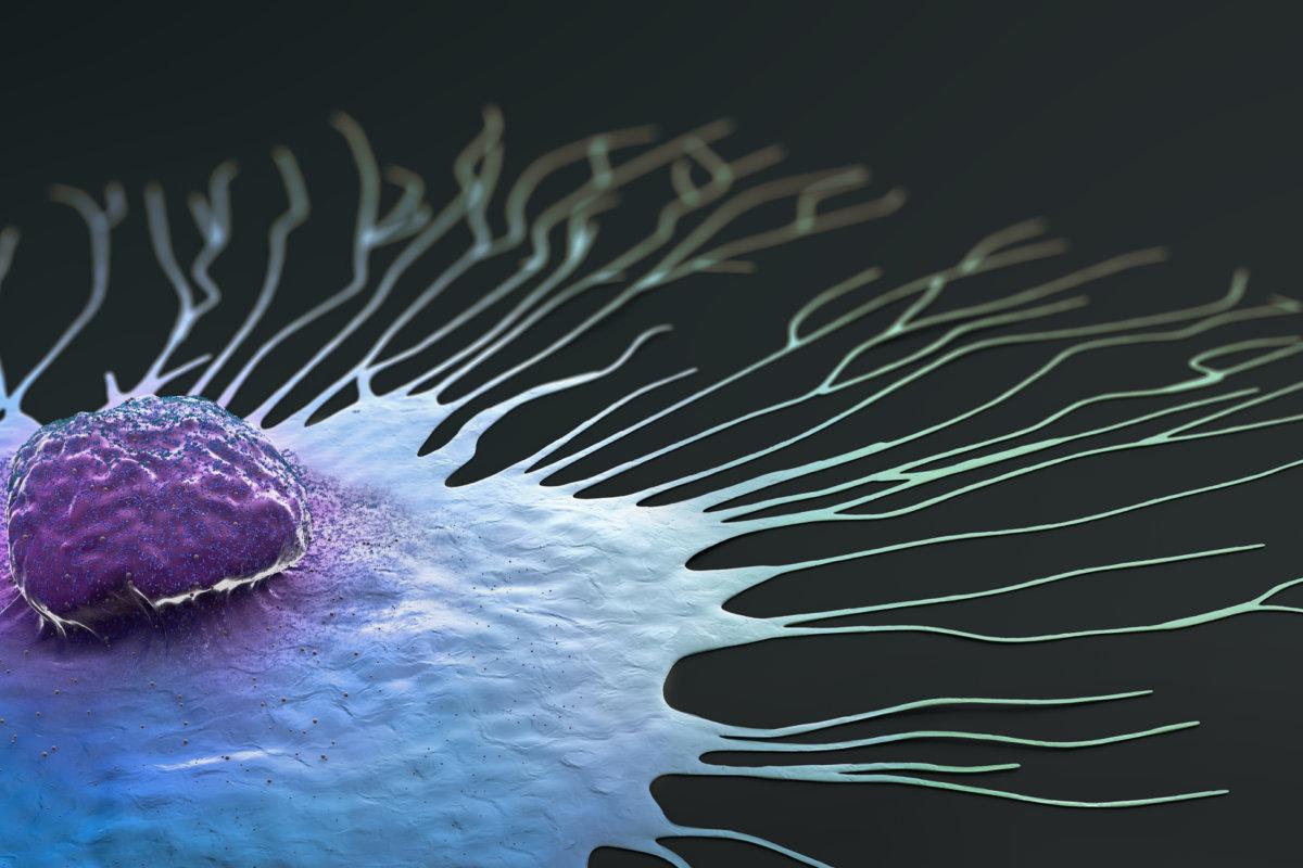 Wissenschaftliche Illustration einer wandernden Brustkrebszelle - 3D-Illustration