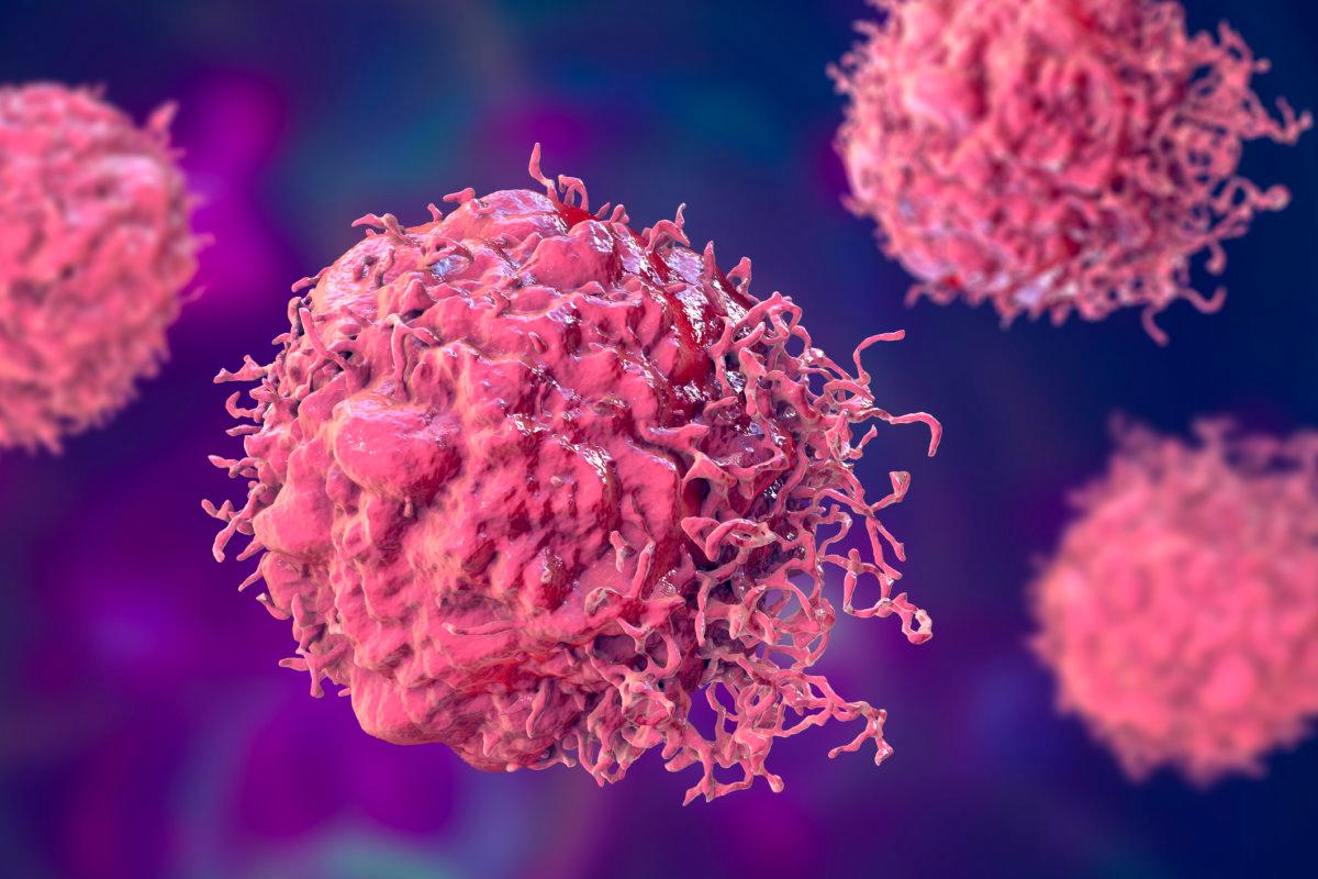 Krebszellen, bösartige Zellen, wissenschaftliche 3D-Illustration