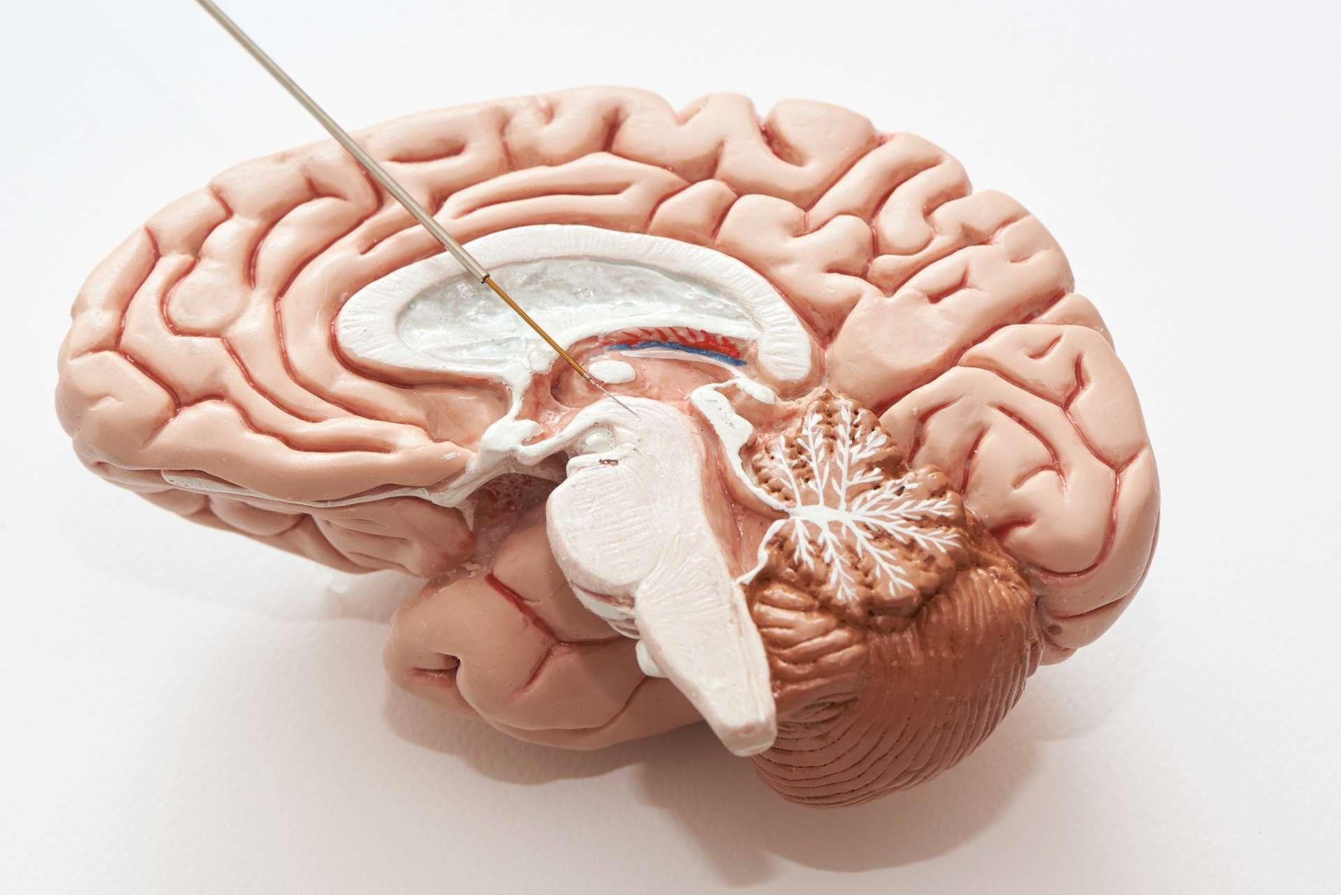 Konzept der Gehirnaufzeichnung im Nucleus subthalamicus bei Parkinson