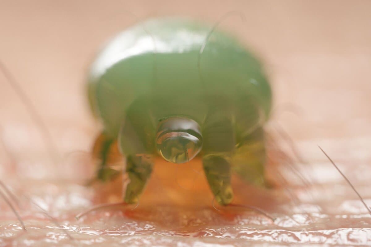 Die Krätze lässt sich üblicherweise mit Permethrin-haltigen Cremes behandeln.