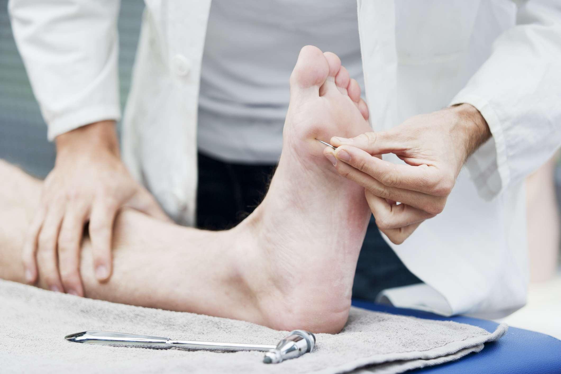 Arzt testet die Empfindlichkeit des Fußes