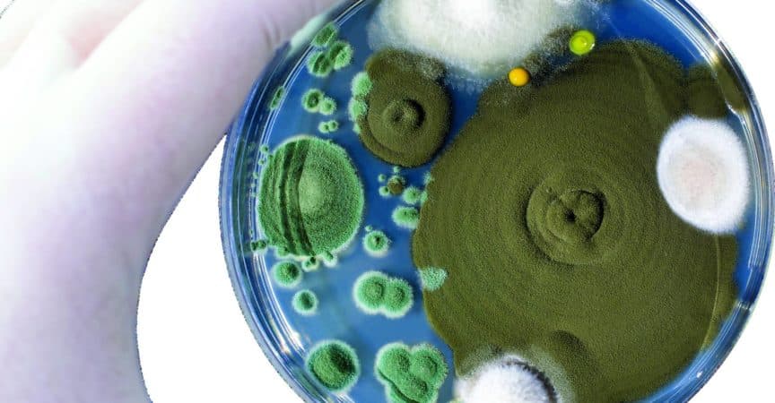 MT_CH_2020_KW49_MTCH_2020_49_S20MTD_2020_48_S10_iStock_Dr_Microbe_1185018433_bearbeitet.psd