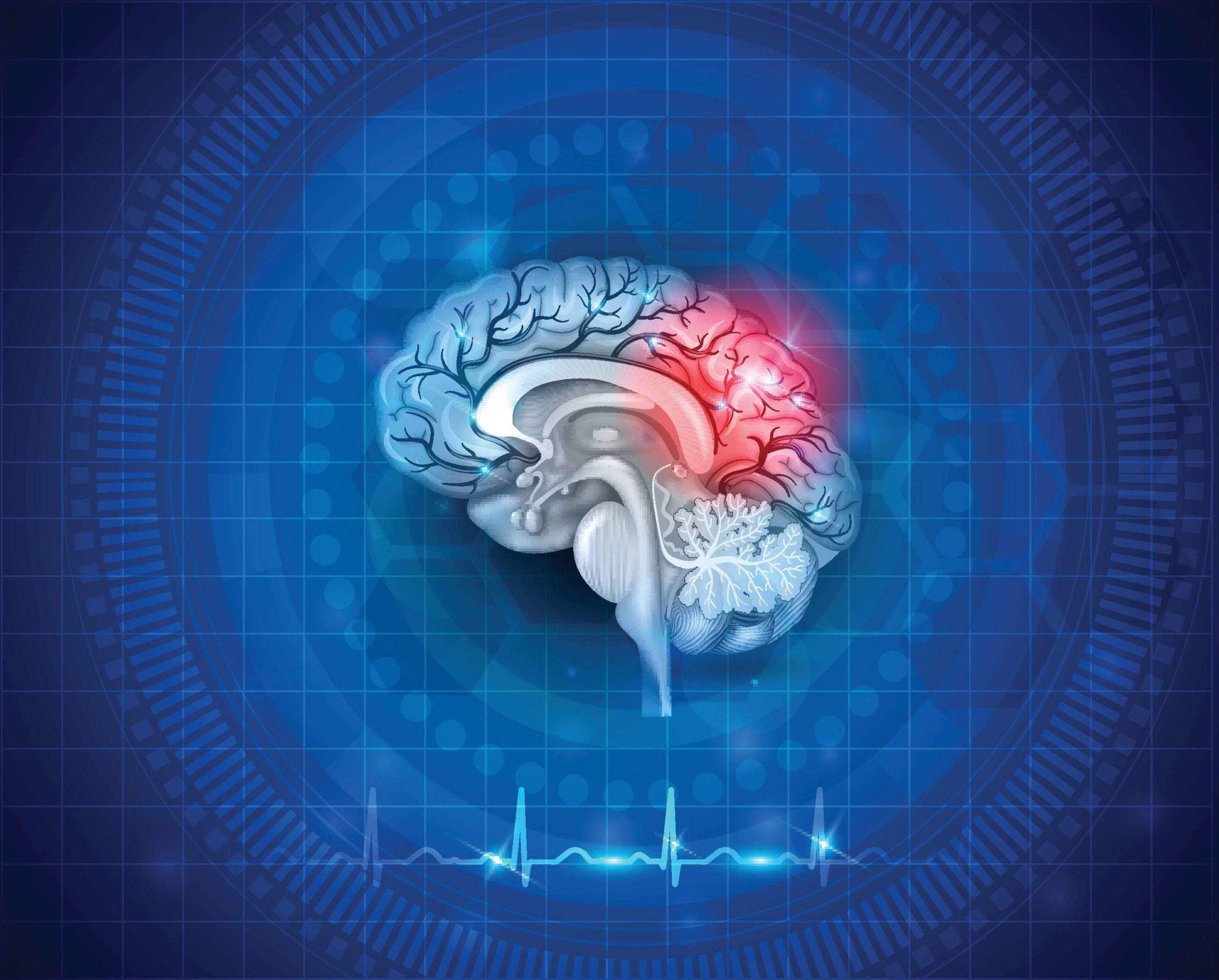 Human brain damage and treatment concept. Abstract blue background with cardiogram.