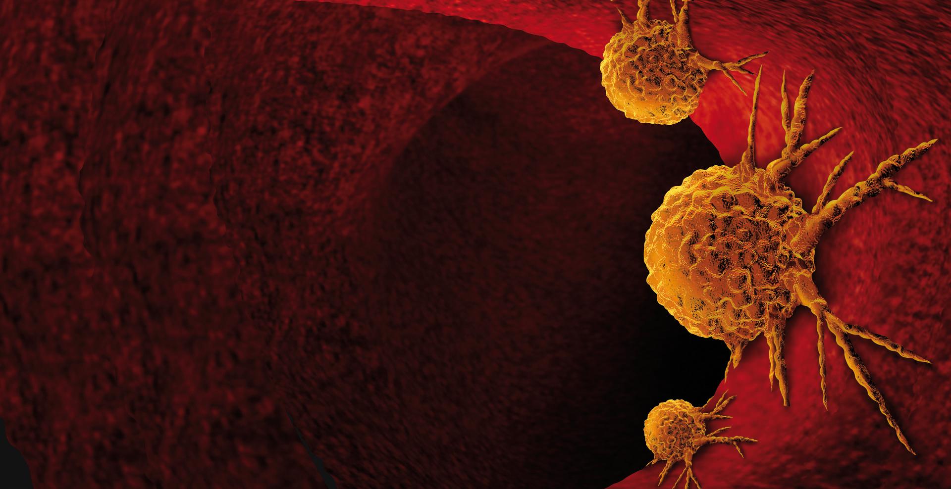 Krebsanatomie im menschlichen Körper als 3D-Render.