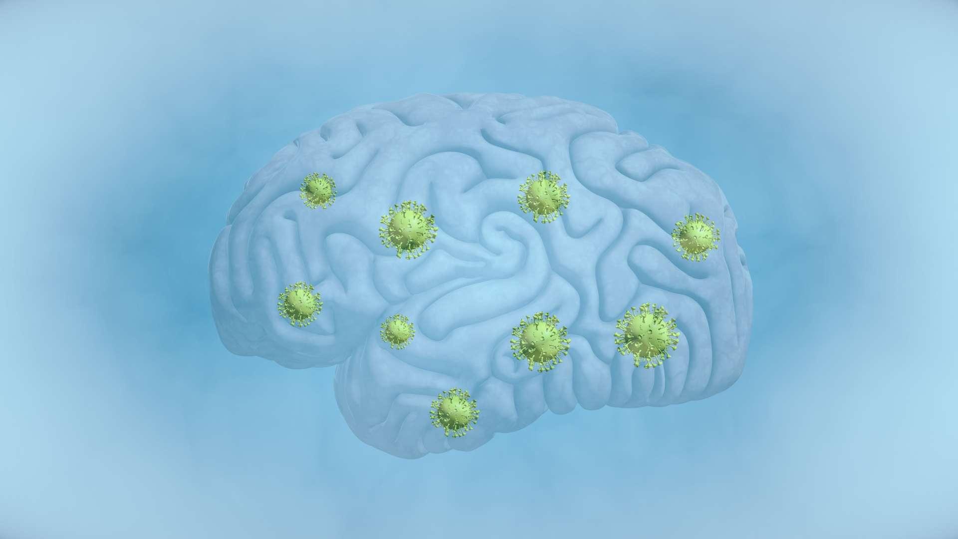 Gehirn, Tumor, COVID-19, Krebs - Krankheit, biomedizinische Illustration