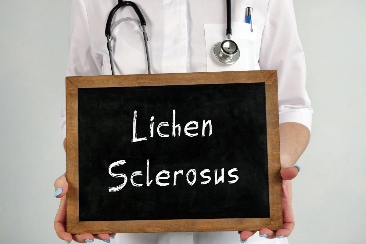 Medizinisches Konzept über Lichen Sclerosus mit Beschriftung auf dem Blatt.
