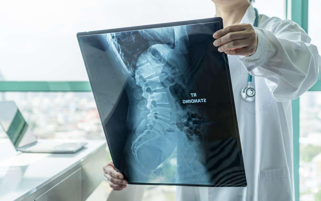 Chirurgischer Arzt, der radiologische Röntgenfilme der Wirbelsäule zur medizinischen Diagnose der Patientengesundheit bei Wirbelsäulenerkrankungen, Knochenkrebserkrankungen, spinaler Muskelatrophie, medizinischem Gesundheitskonzept betrachtet