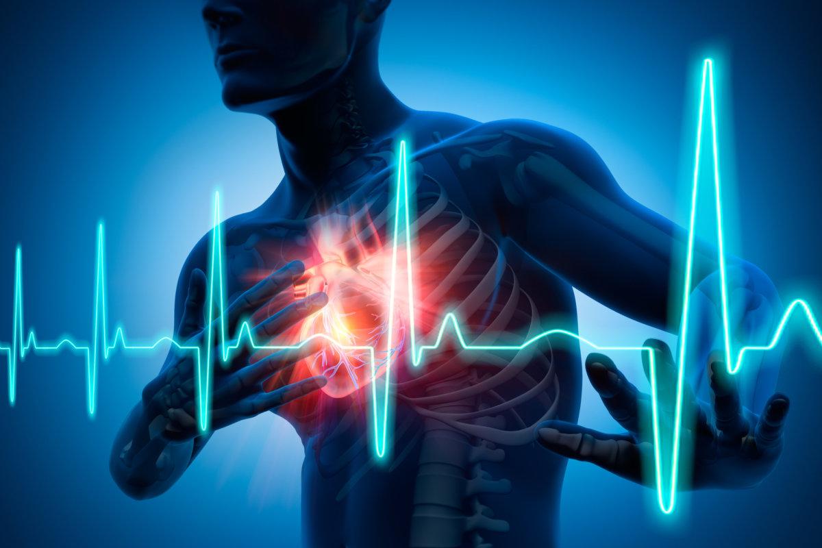 3D-Rendering – Brustschmerzen – Herzinfarkt – medizinische Illustration