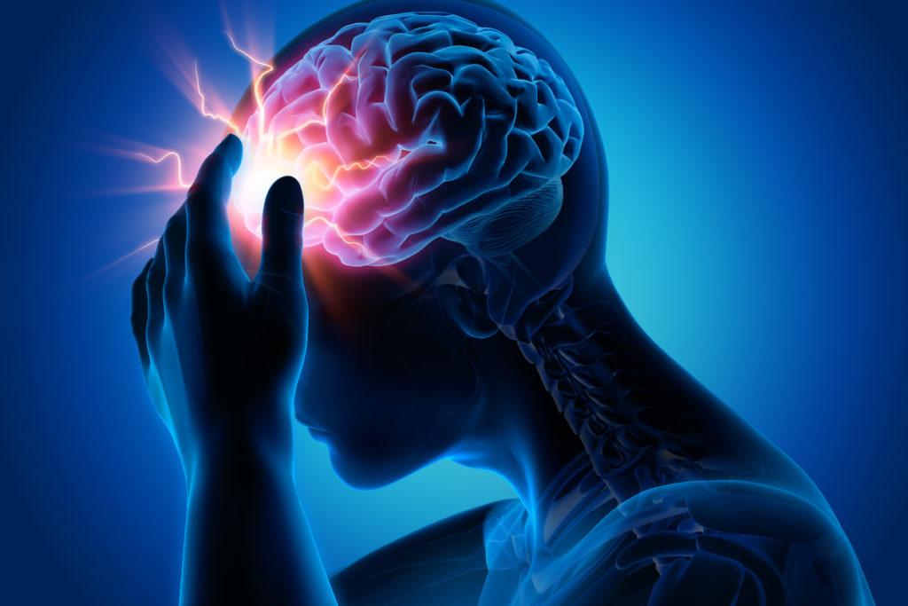 Starke Kopfschmerzen - Migräne - Medizinische Illustration - 3D Rendering