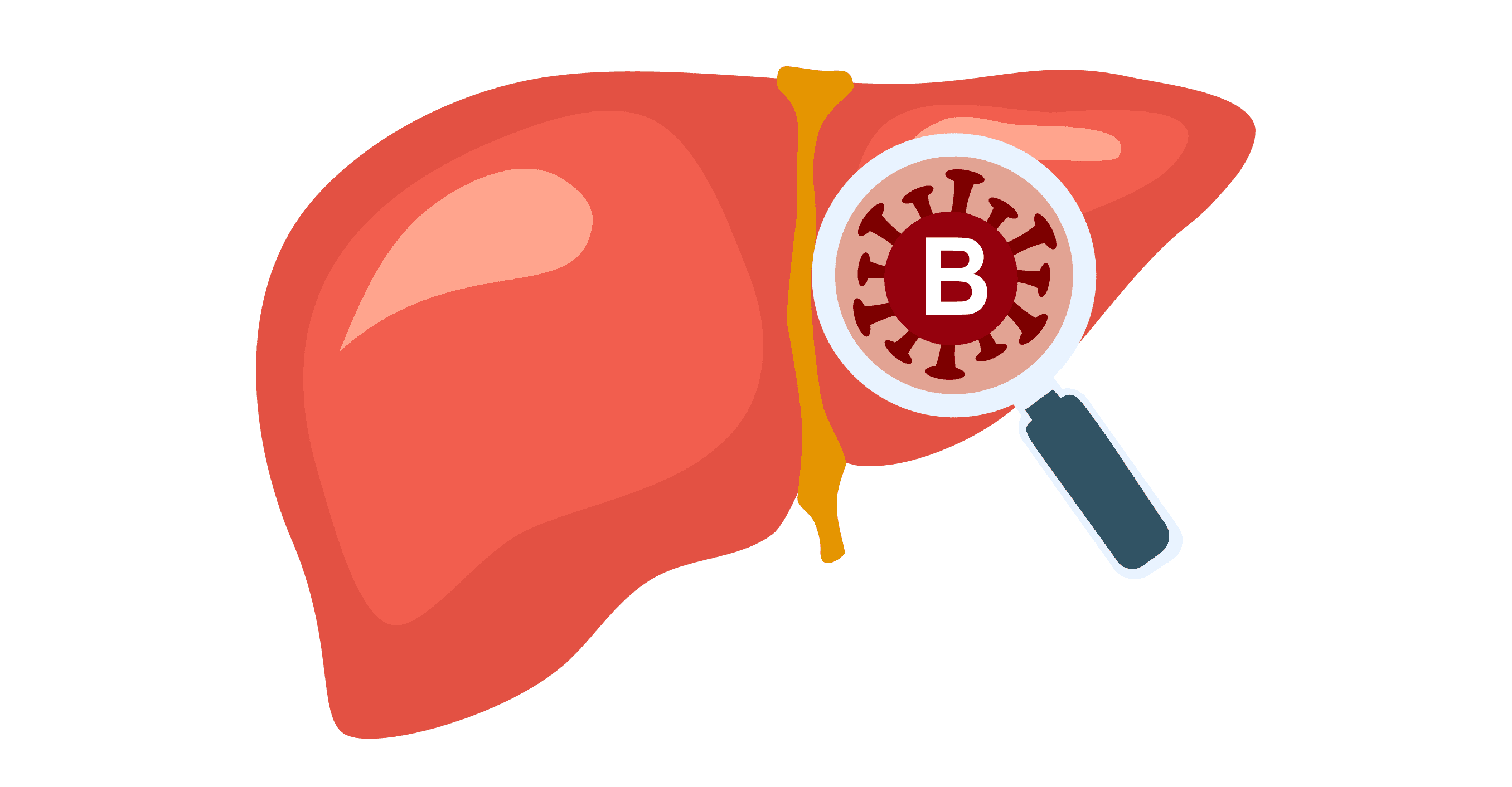 Hepatitis-B-Krankheit Konzept Vektor-Illustration