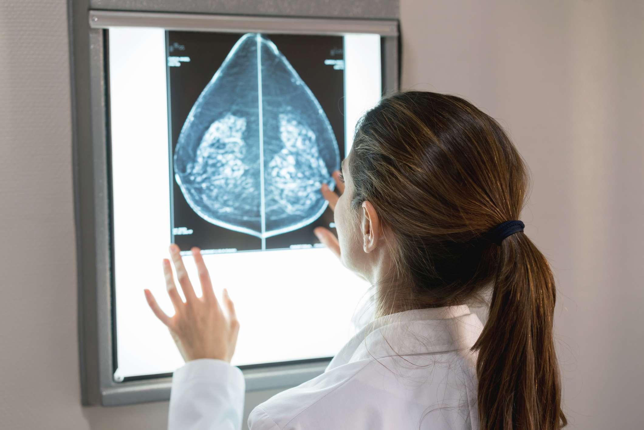 Nicht erkennbare Gynäkologin, die im Krankenhaus eine Mammographie eines Patienten betrachtet