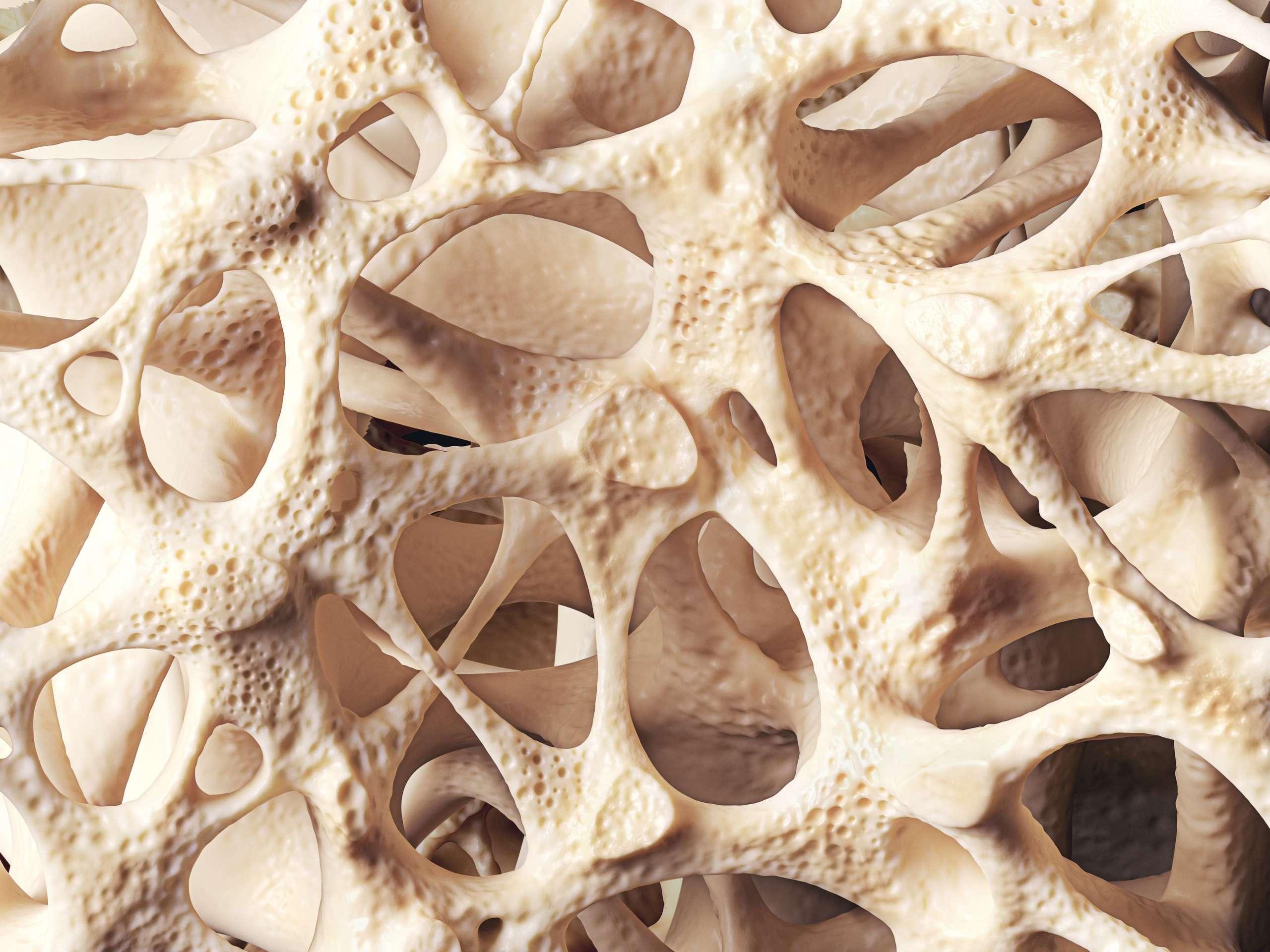 Realistische Knochenschwammstruktur Nahaufnahme, Knochenstruktur von Osteoporose betroffen, 3D-Darstellung