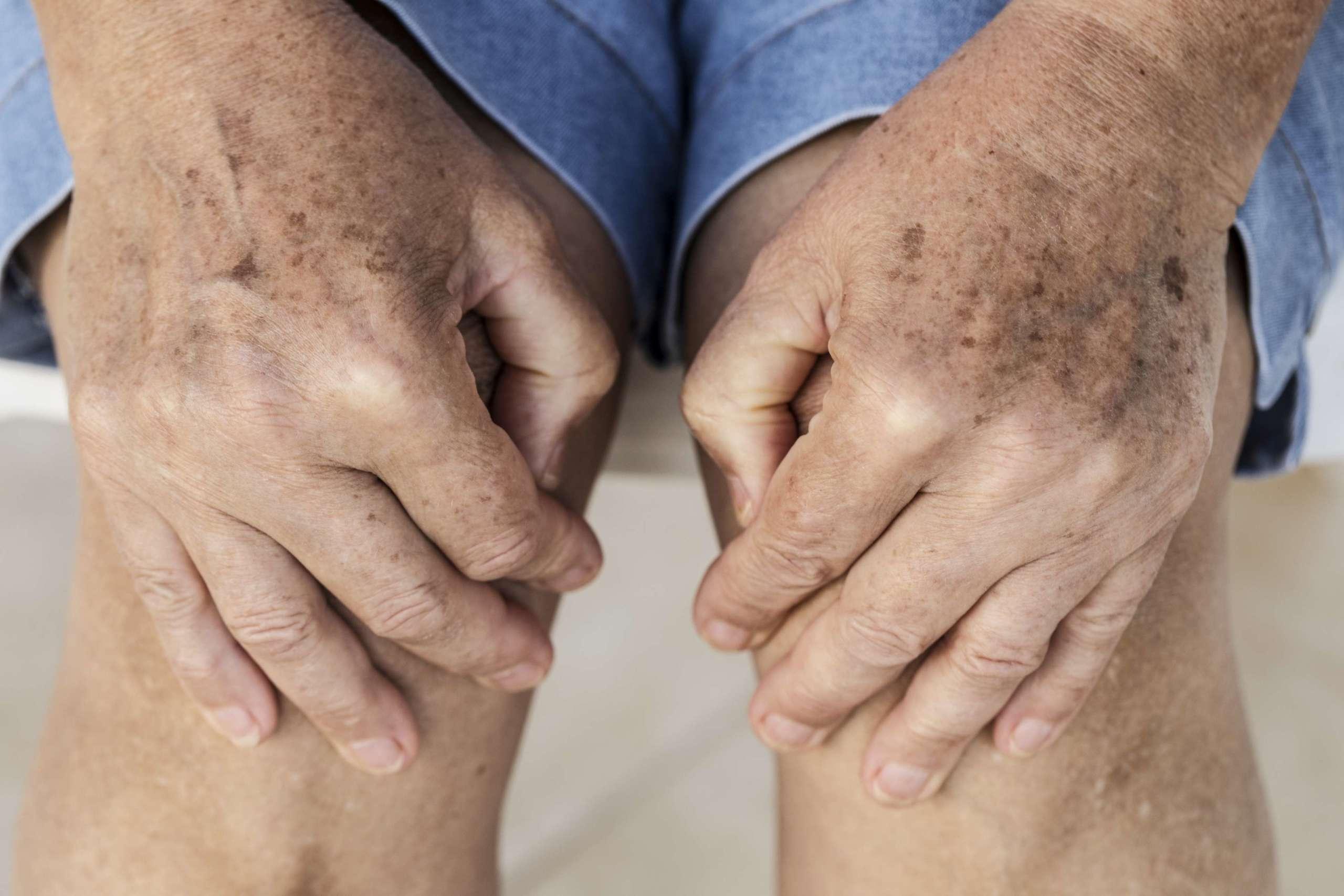 Älterer Erwachsener mit Knieschmerzen hält seine Knie.