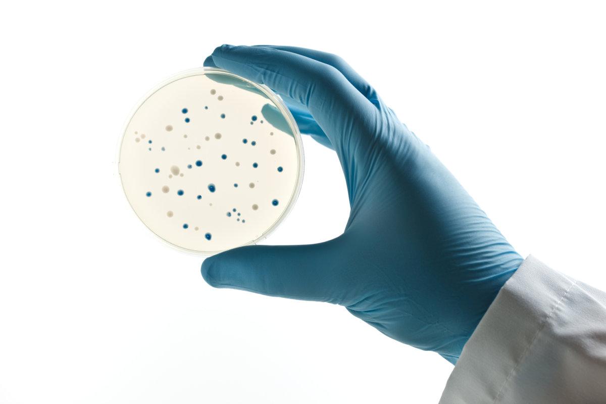 Wissenschaftler, der eine Petrischale mit Bakterienklonen hält