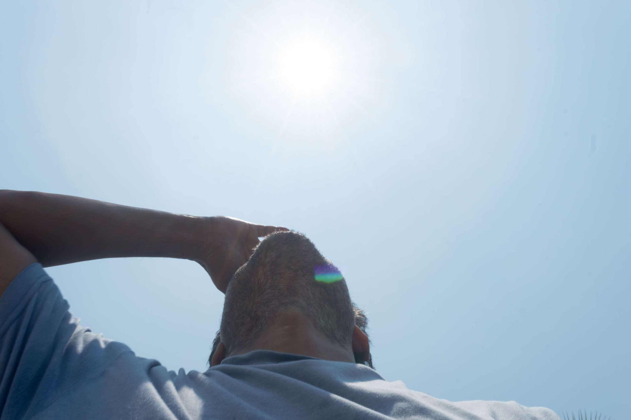 Sengend heiße Sommersonnenstrahlen, die auf den menschlichen Kopf strömen. Hand, die Sonnenlichtwärmetemperatur bedeckt. Schutz vor ultraviolettem Licht und Sonnenbrandhintergrund. Sonnenstich, Hitzschlag, Treibhauseffekt.