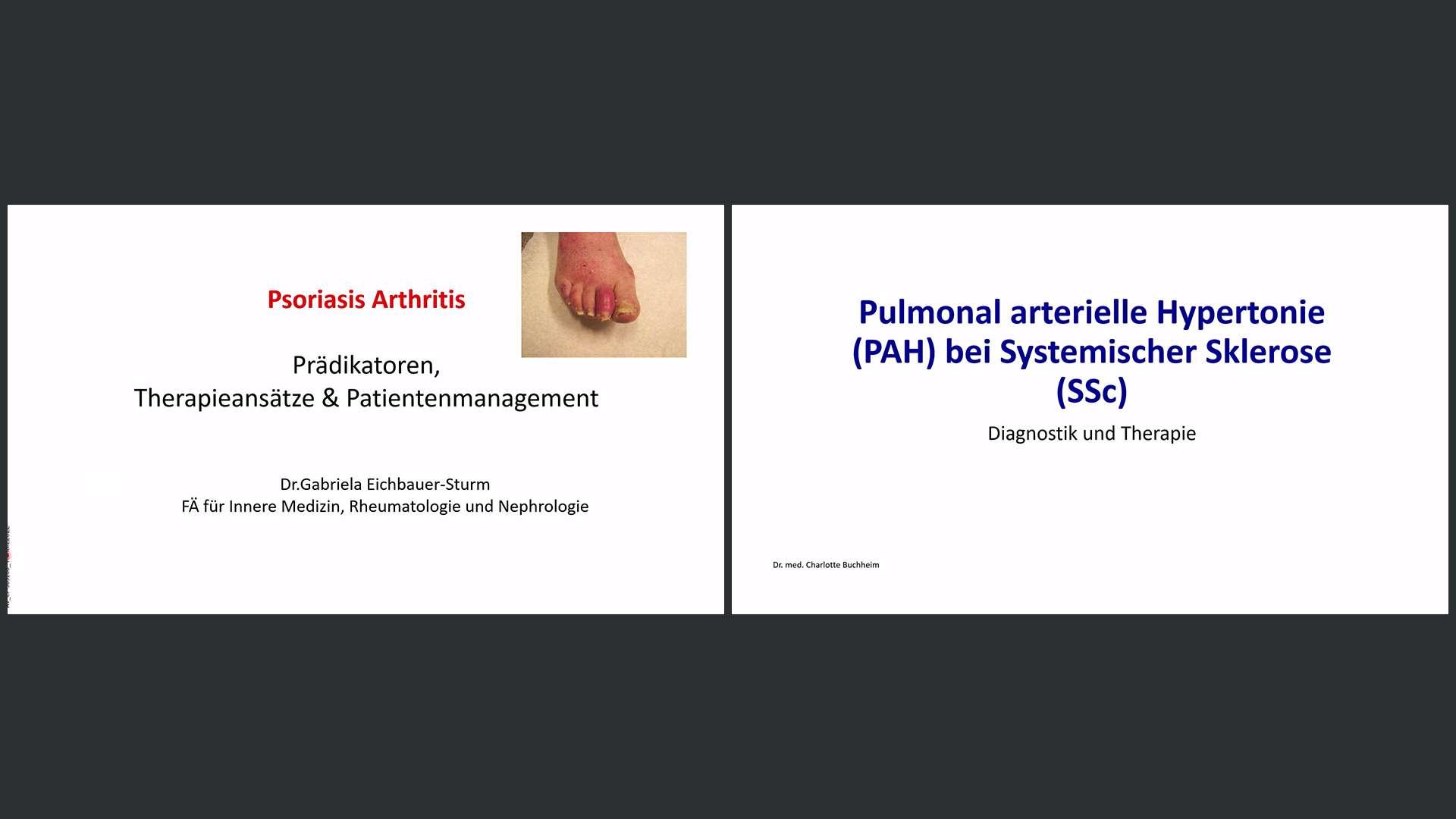 Psoriasis-Arthritis und PAH bei Systemischer Sklerose