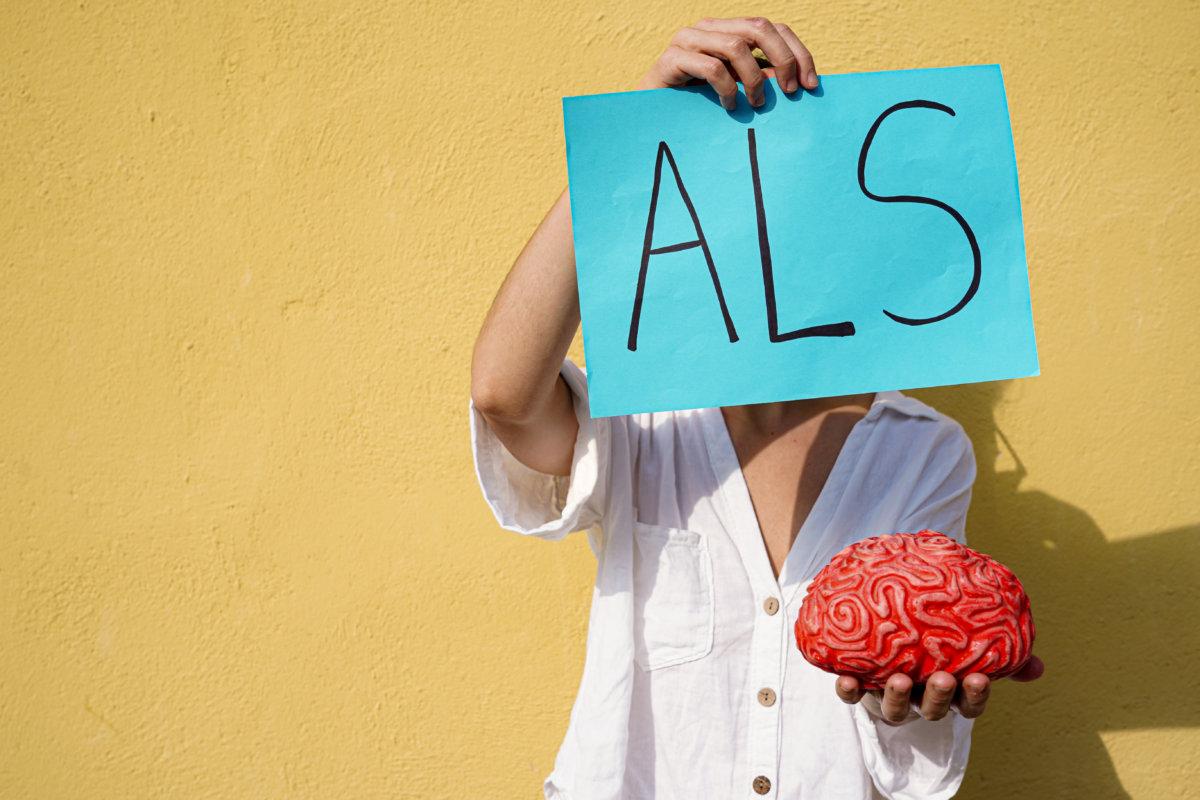 Nicht wiederzuerkennende Frau mit einer ALS-Akronymkarte und einem roten Gehirn