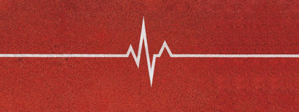 Konzeptionelles Kardiogramm des Herzschlags