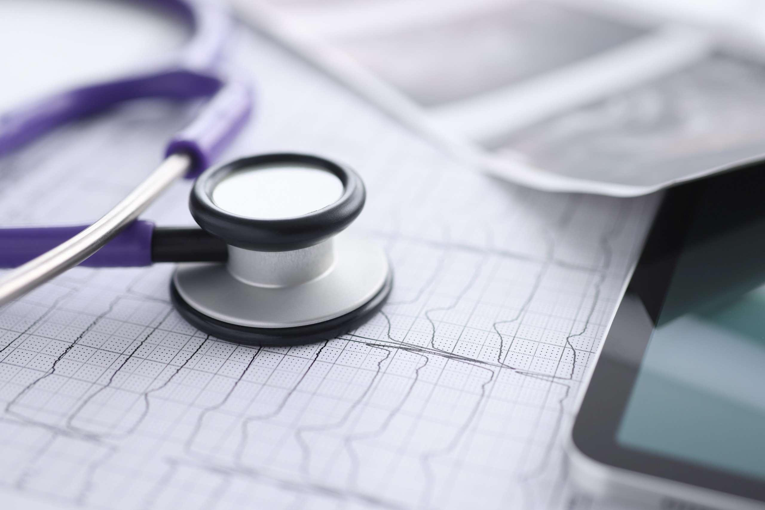 Auf dem Tisch befindet sich ein Kardiogramm-Tablet und ein Stethoskop. Untersuchung des Konzepts des Herz-Kreislauf-Systems