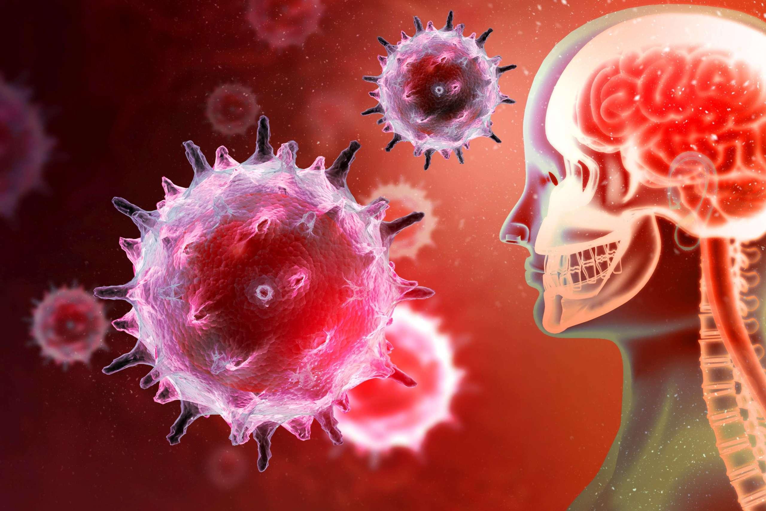 Viren oder Bakterien, die das menschliche Gehirn angreifen. Virusinfektion. 3D-Darstellung