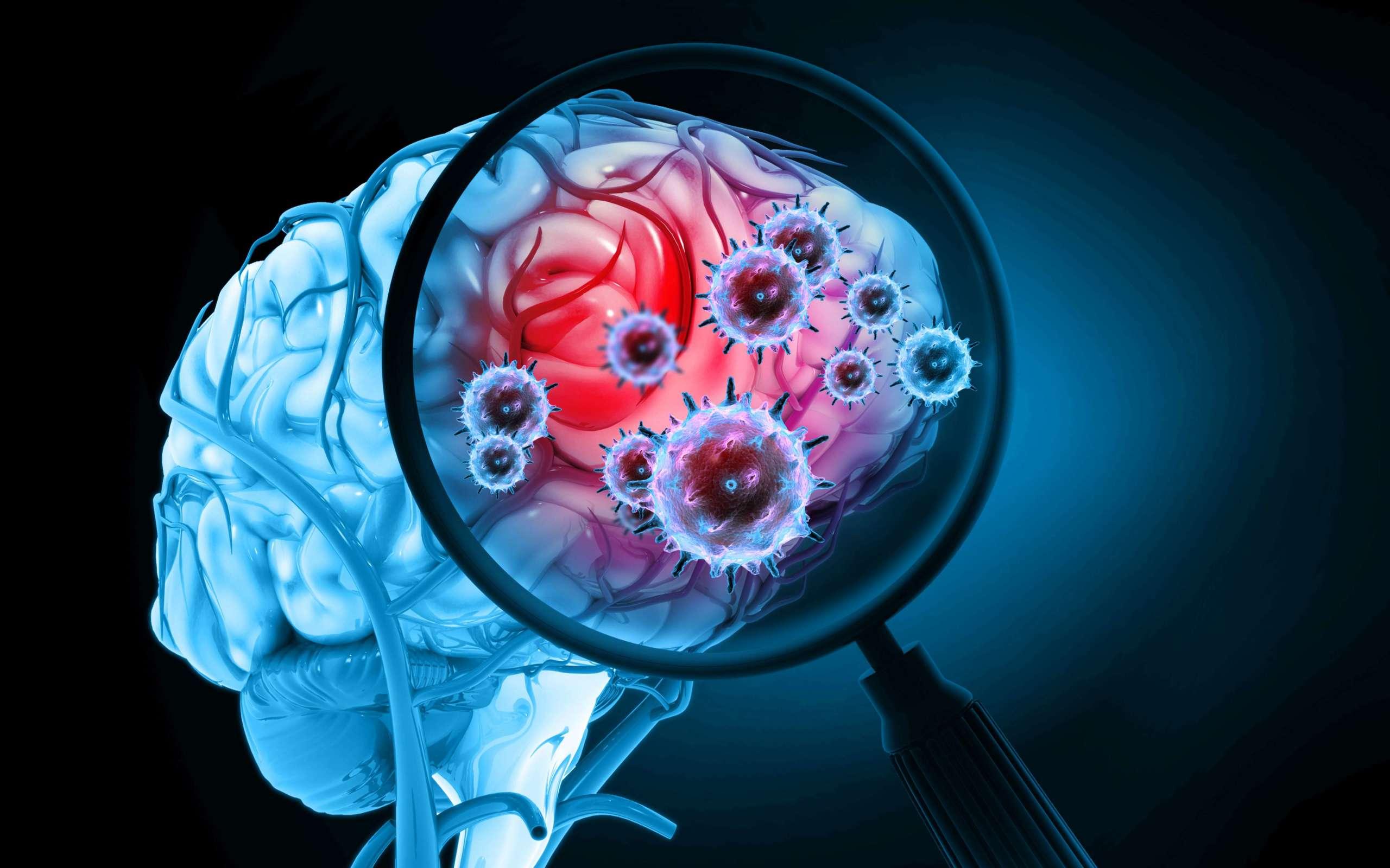 Virusinfektion des Gehirns auf wissenschaftlichem Hintergrund