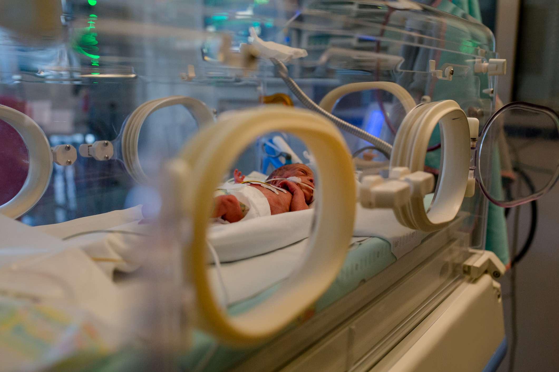 verdrahtetes Frühgeborenes liegt im Inkubator