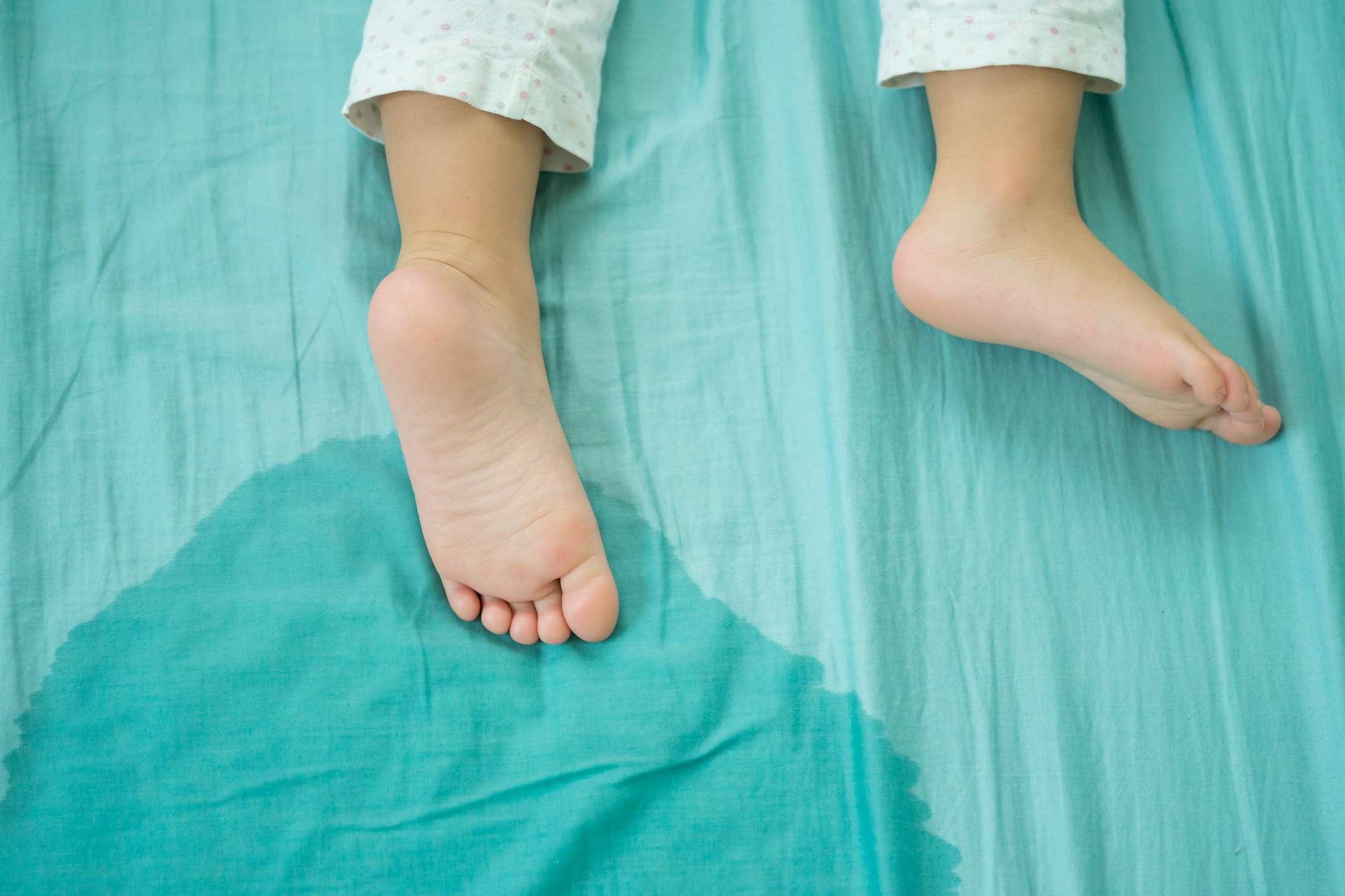 Kinderfüße und pinkeln in einer Matratze.kleine Mädchenfüße und pinkeln am Morgen in Bettlaken.Entwicklungskonzept für Kinder.
