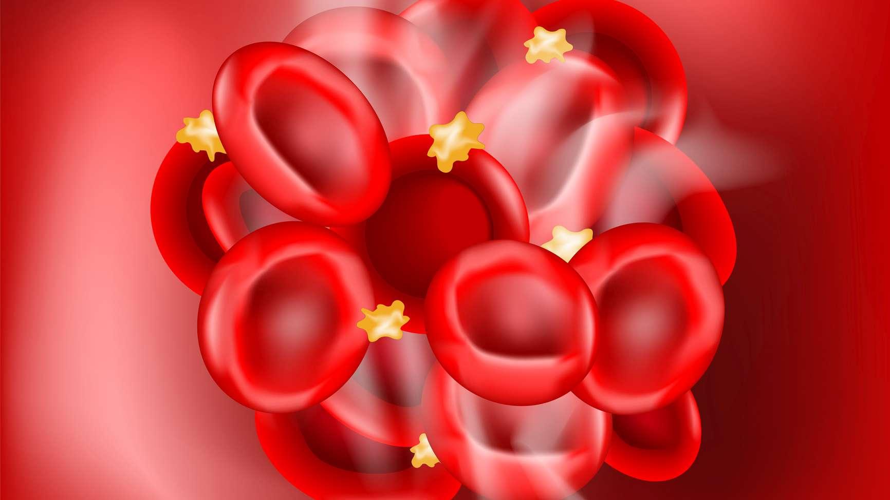 Blutgerinnsel auf rotem Hintergrund. Thrombus, der ein Blutgefäß verstopft hat. Blutgerinnung. Hämostase. Vektor-Illustration
