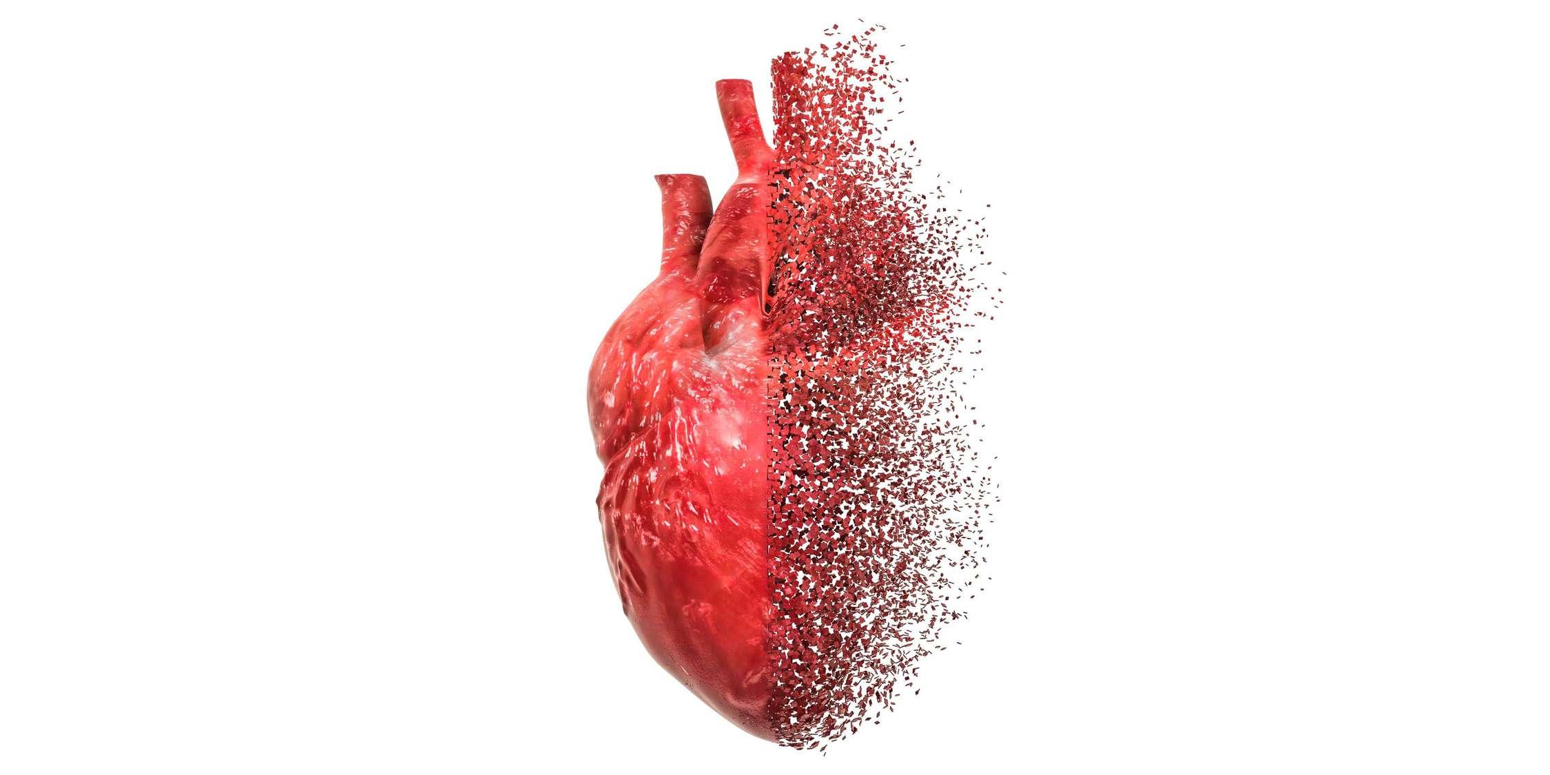Semaglutid ist bei adipositasbedingter Herzinsuffizienz wirksam