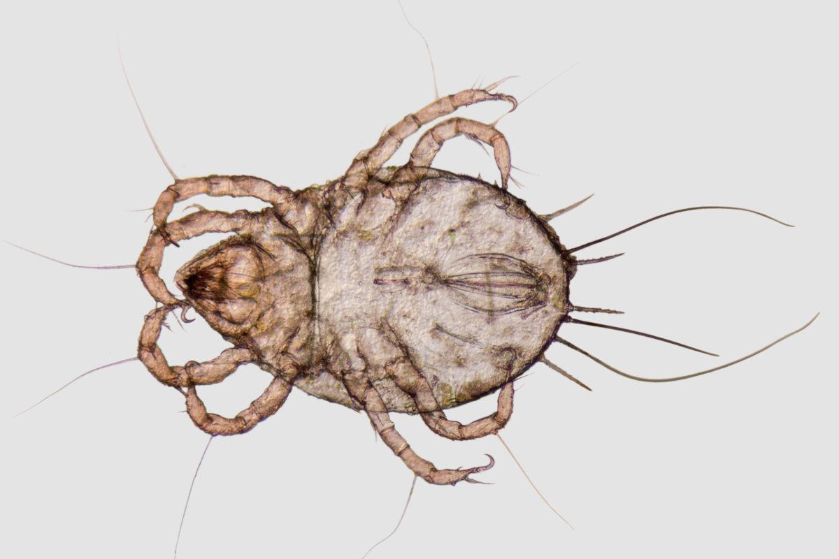 microscopic shot showing a house dust mite