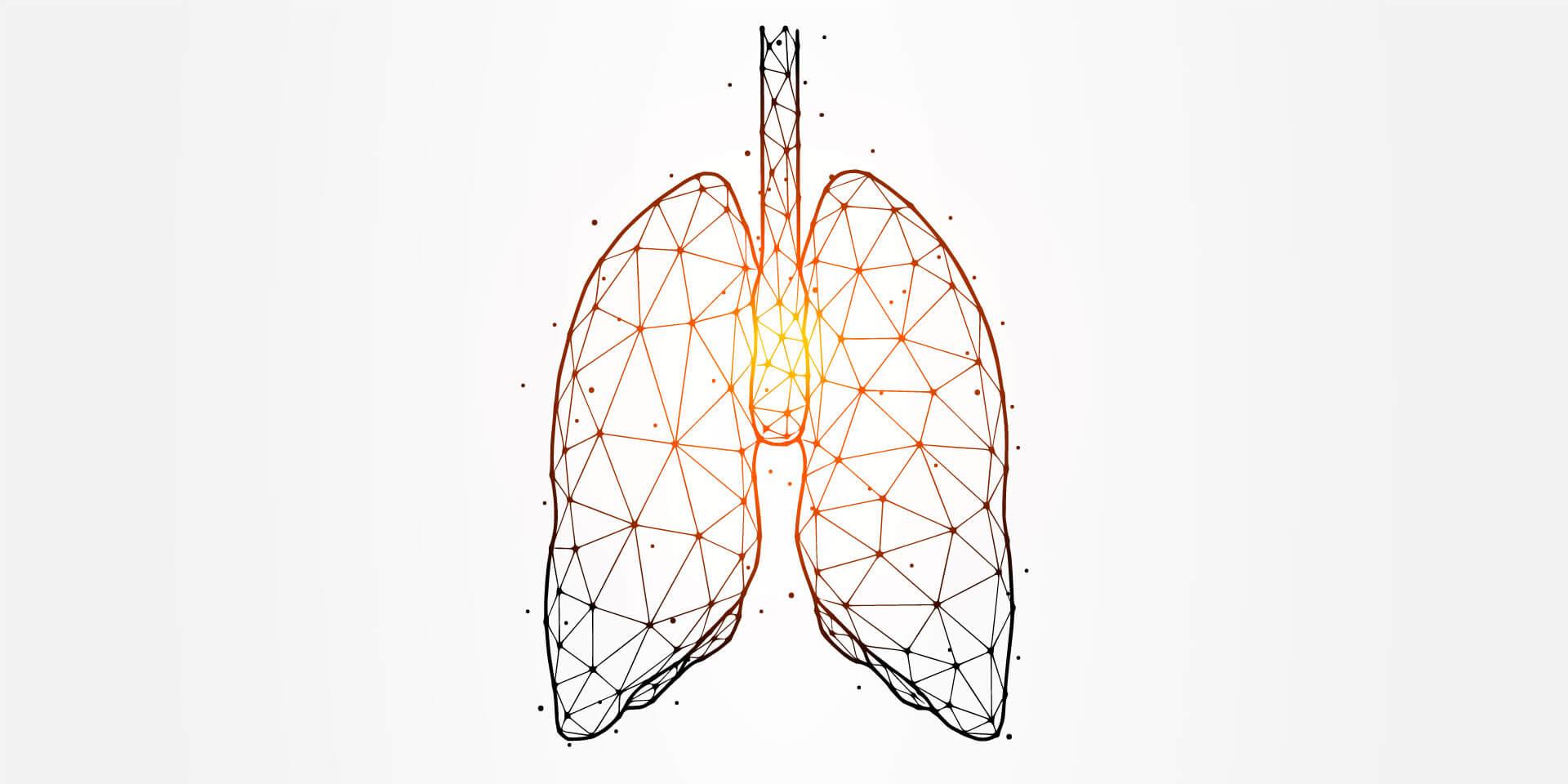 Biologika: Fürs T2-low-Asthma fehlen immer noch Konzepte