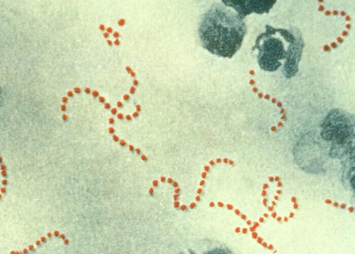 Streptococcus_pyogenes