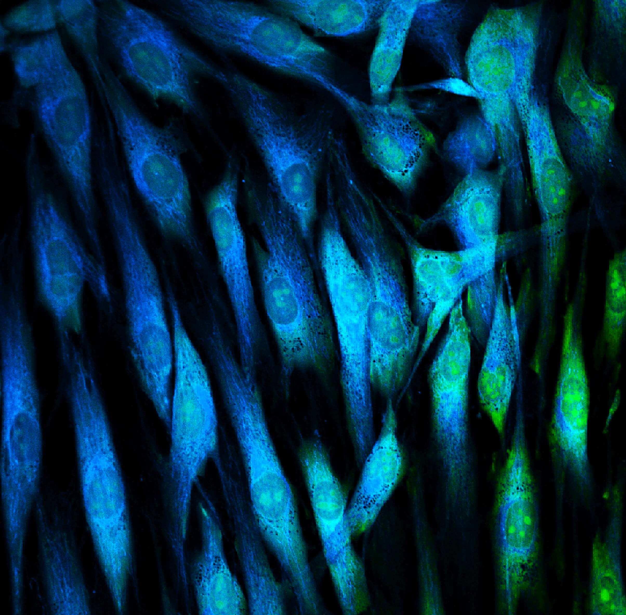 Mit fluoreszierenden Farbstoffen markierte Fibroblasten (Hautzellen).