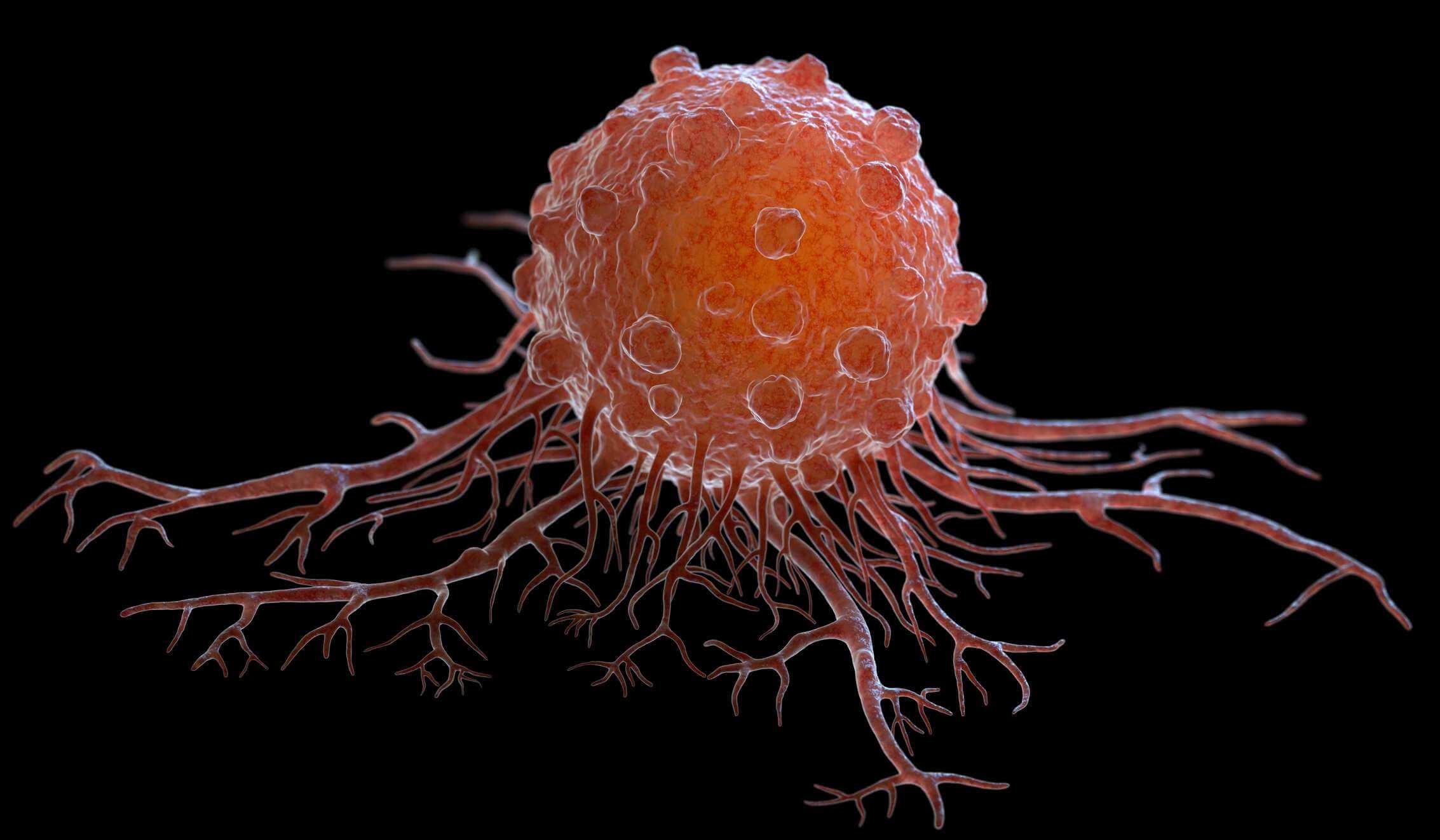 Krebszellen können in andere Körpergewebe oder Organe wandern und dort Metastasen bilden. 3D-Darstellung