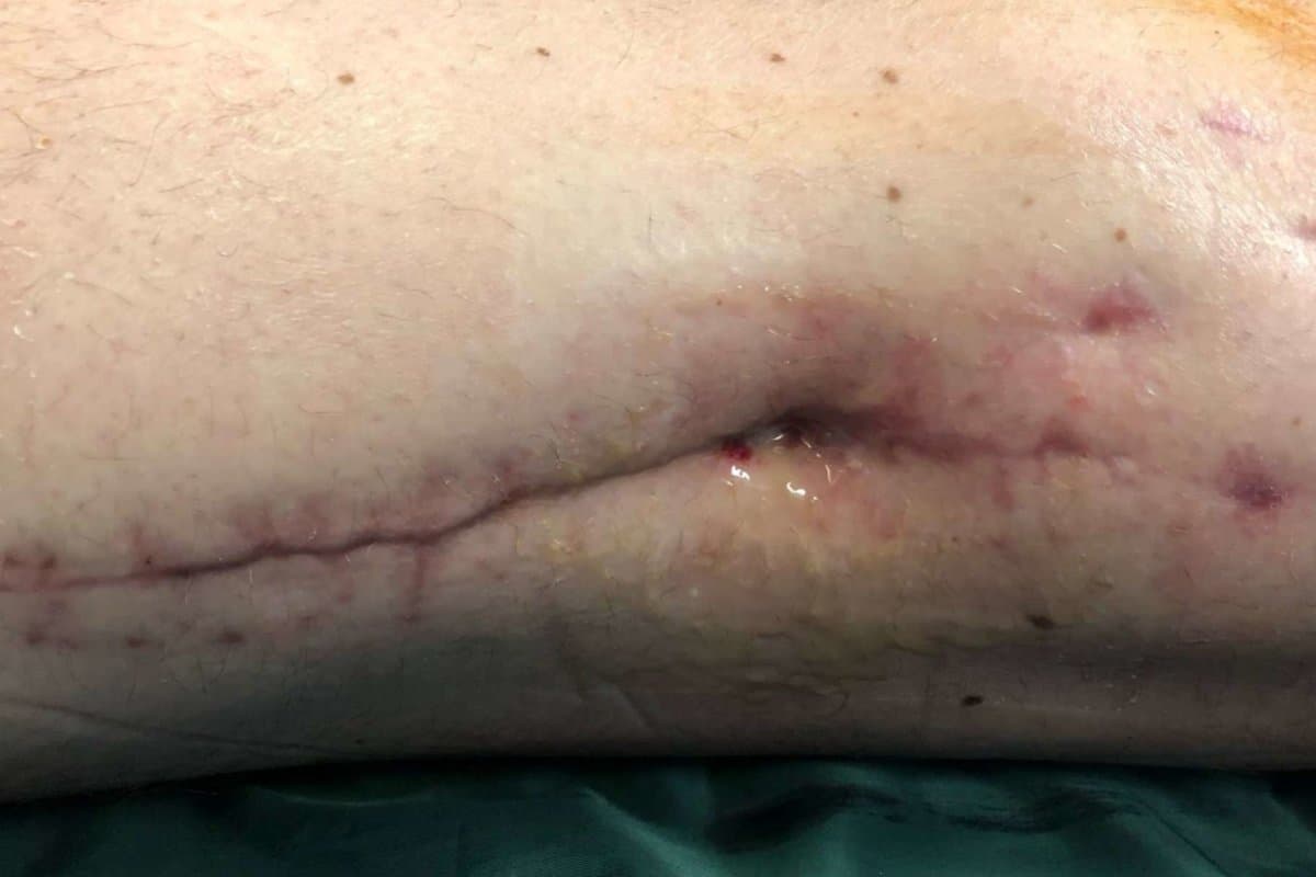 Kriegsverletzung2_Copyright Charite Universitätsmedizin