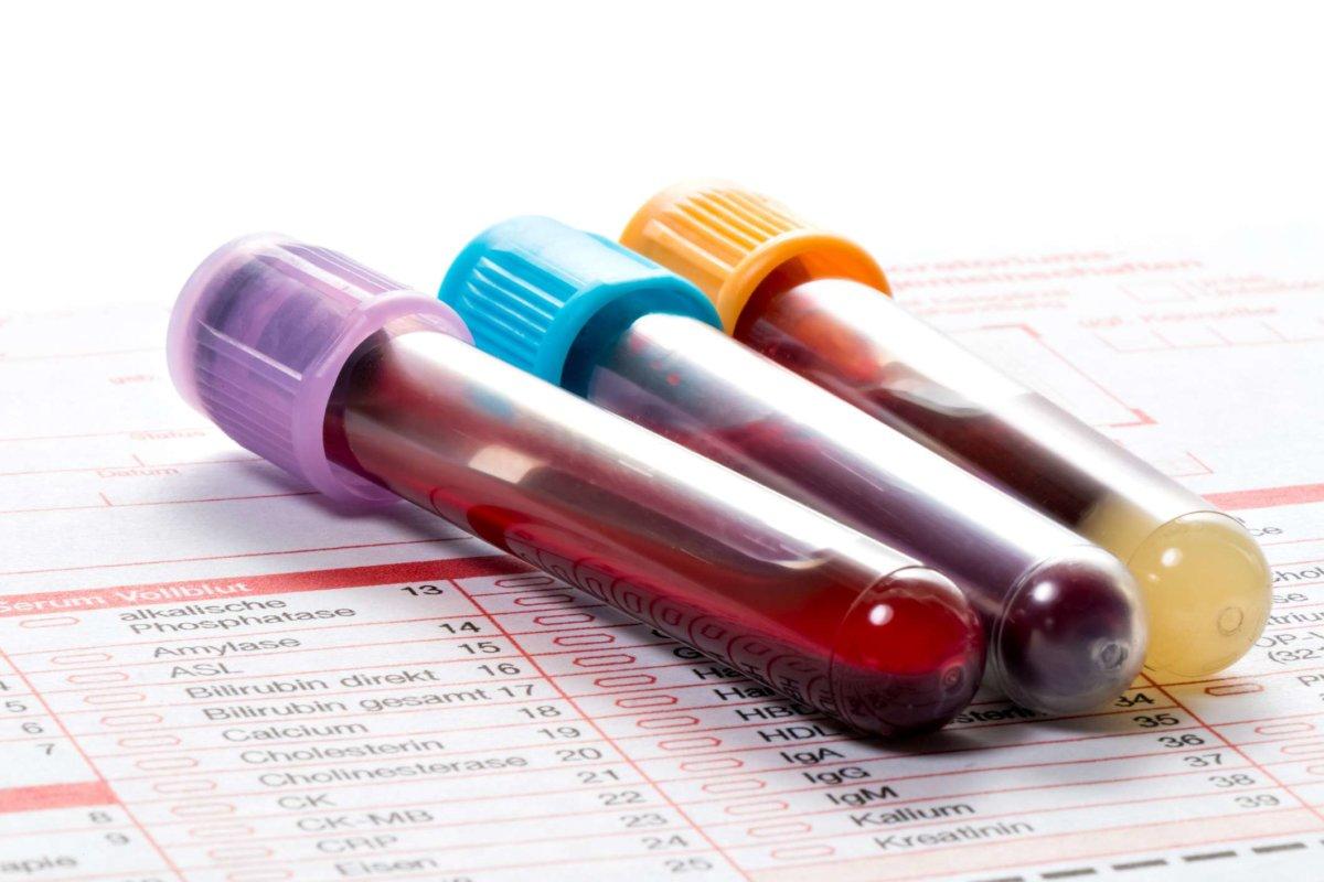Blutproben werden auf einem Laborbogen zur Ermittlung der Blutwerte abgegeben