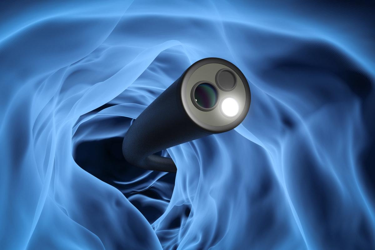 Koloskopie-Technologiekonzept mit 3D-Röntgenendoskop im Inneren des Darms