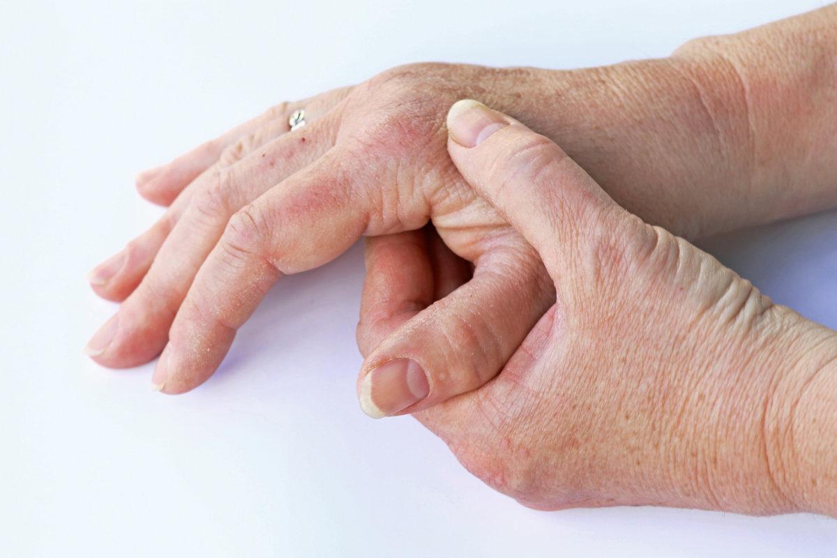 Eine ältere Frau hat Schmerzen in den Händen