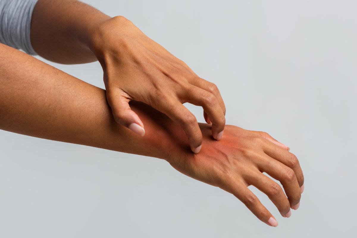 Ausschnitt einer Afro-Frau, die sich an der Hand kratzt und an Psoriasis leidet, grauer Hintergrund