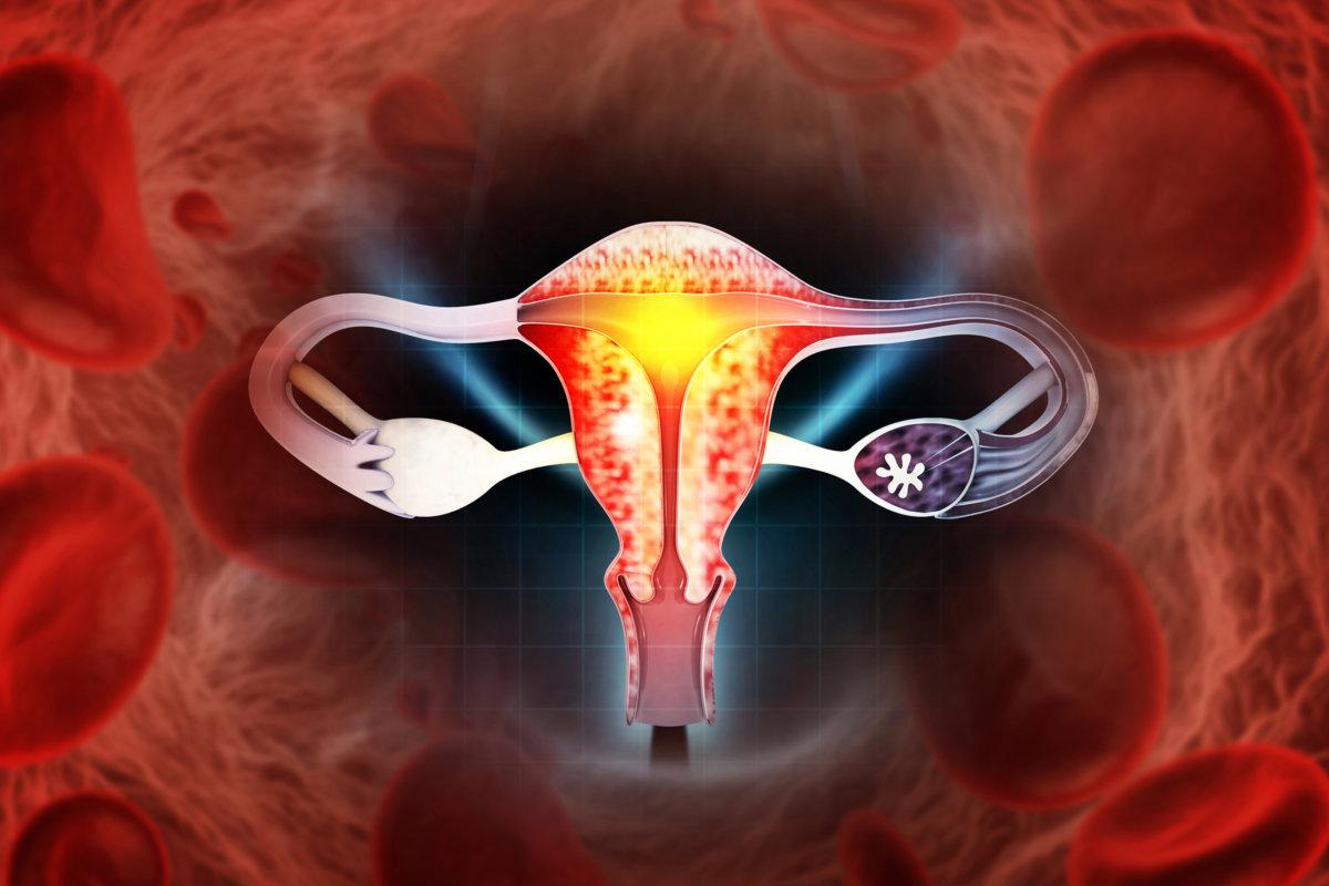 Female reproductive system diseases. Uterus cancer and endometrial malignant tumor as a uterine medical concept. 3d illustration