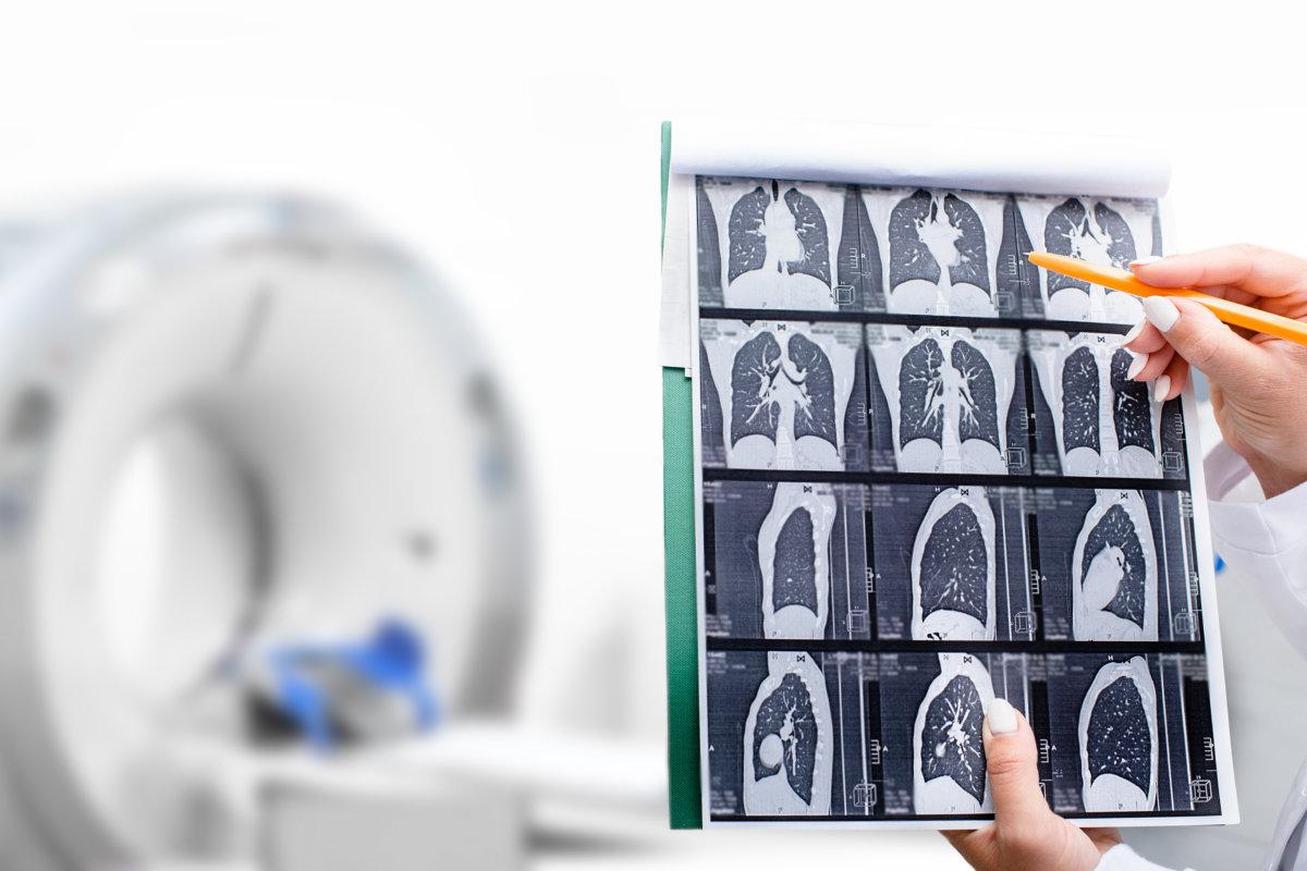 Radiologe zeigt Tomographiescan der Lunge eines Patienten über einem CT-Gerät.