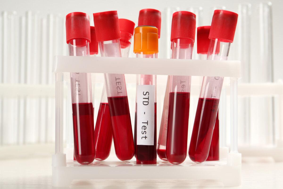 Röhrchen mit Blutproben im Rack auf weißem Hintergrund. STD-Test