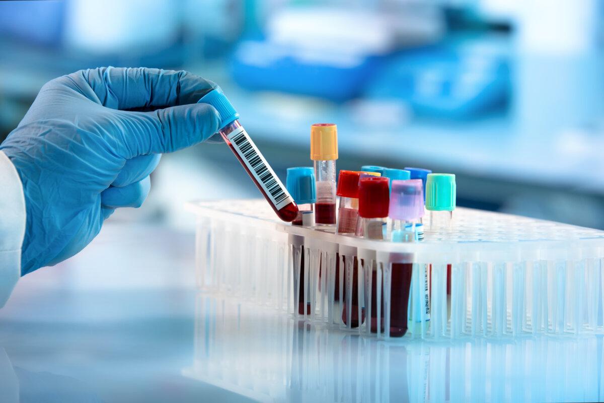 Techniker führt Blutröhrchentest im Forschungslabor durch