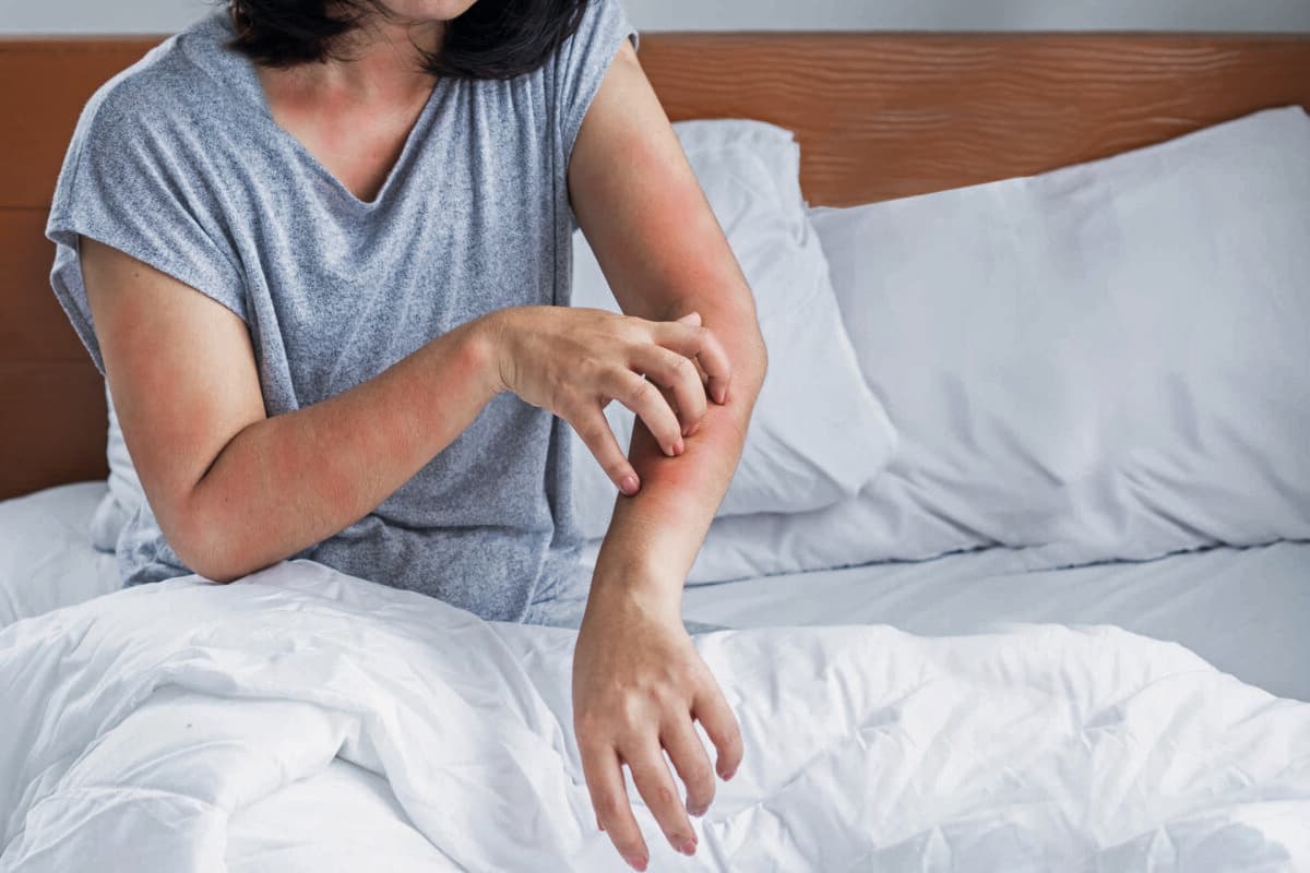 Frau hat ein Problem mit einer Allergie gegen Hausstaubmilben und kratzt sich mit der Hand an ihrer juckenden und