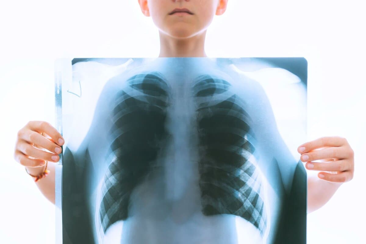 Junge im Teenager-Alter hält ein Röntgen der Lunge und der Brust hoch.
