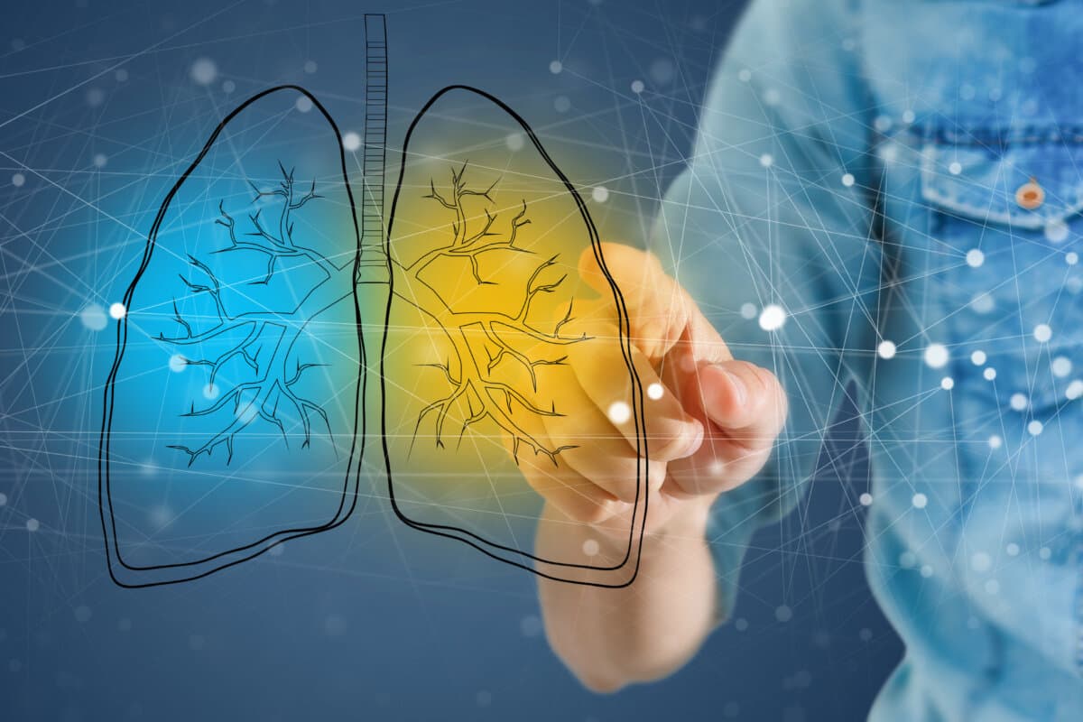 Künstliche Intelligenz als Tool zum Lungenkrebs-Screening