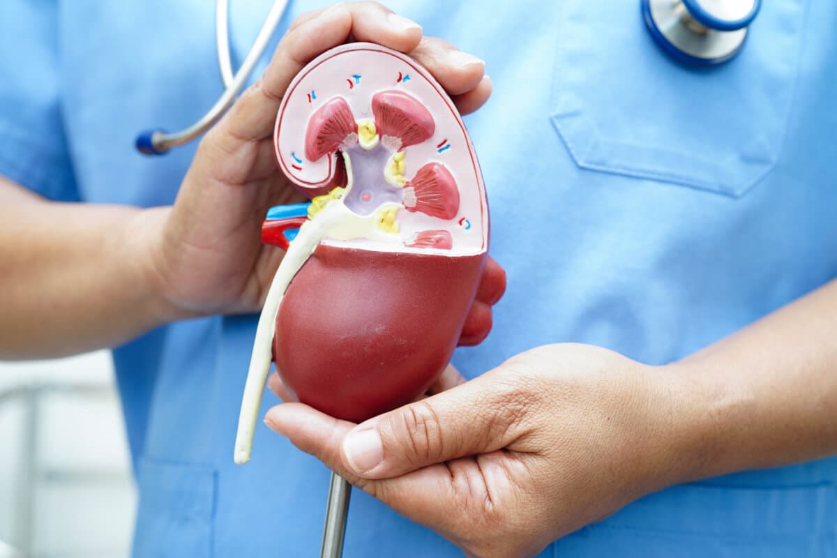 Chronic kidney disease, doctor with model for treatment urinary system, urology, Estimated glomerular filtration rate eGFR.