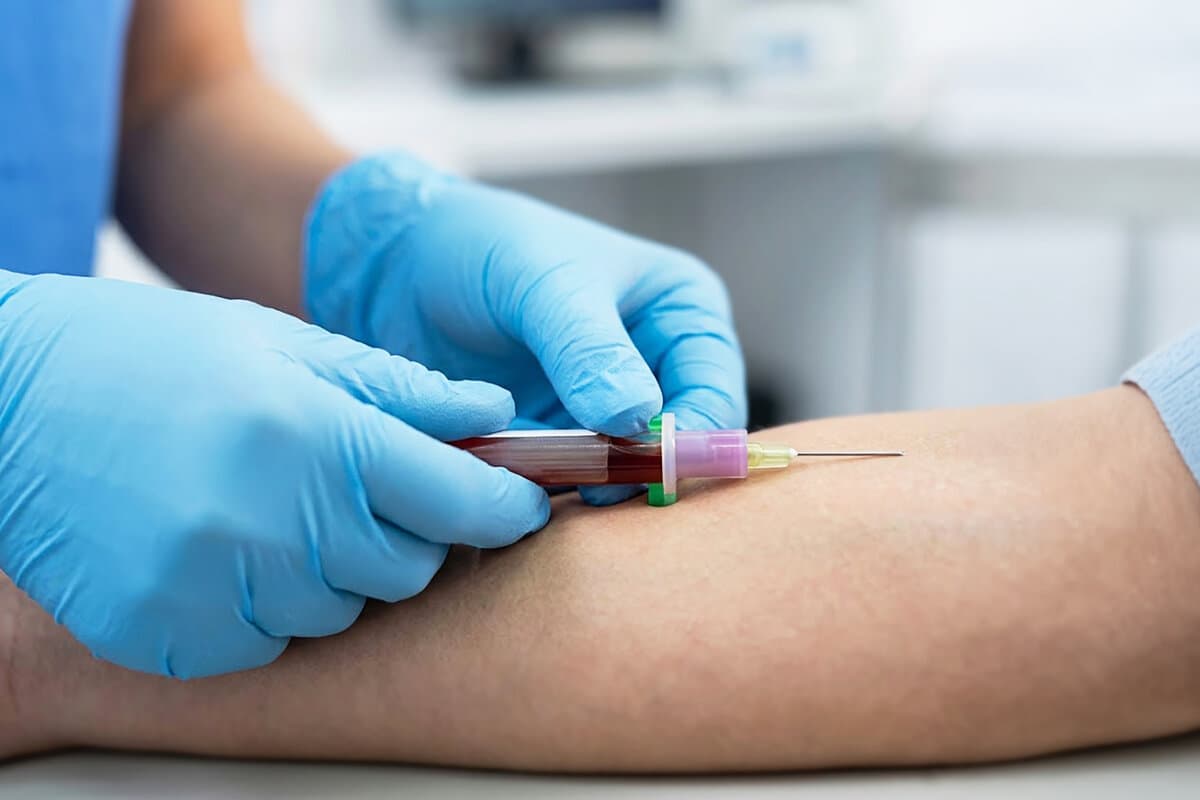 Blood sampling procedure in hospital close up.