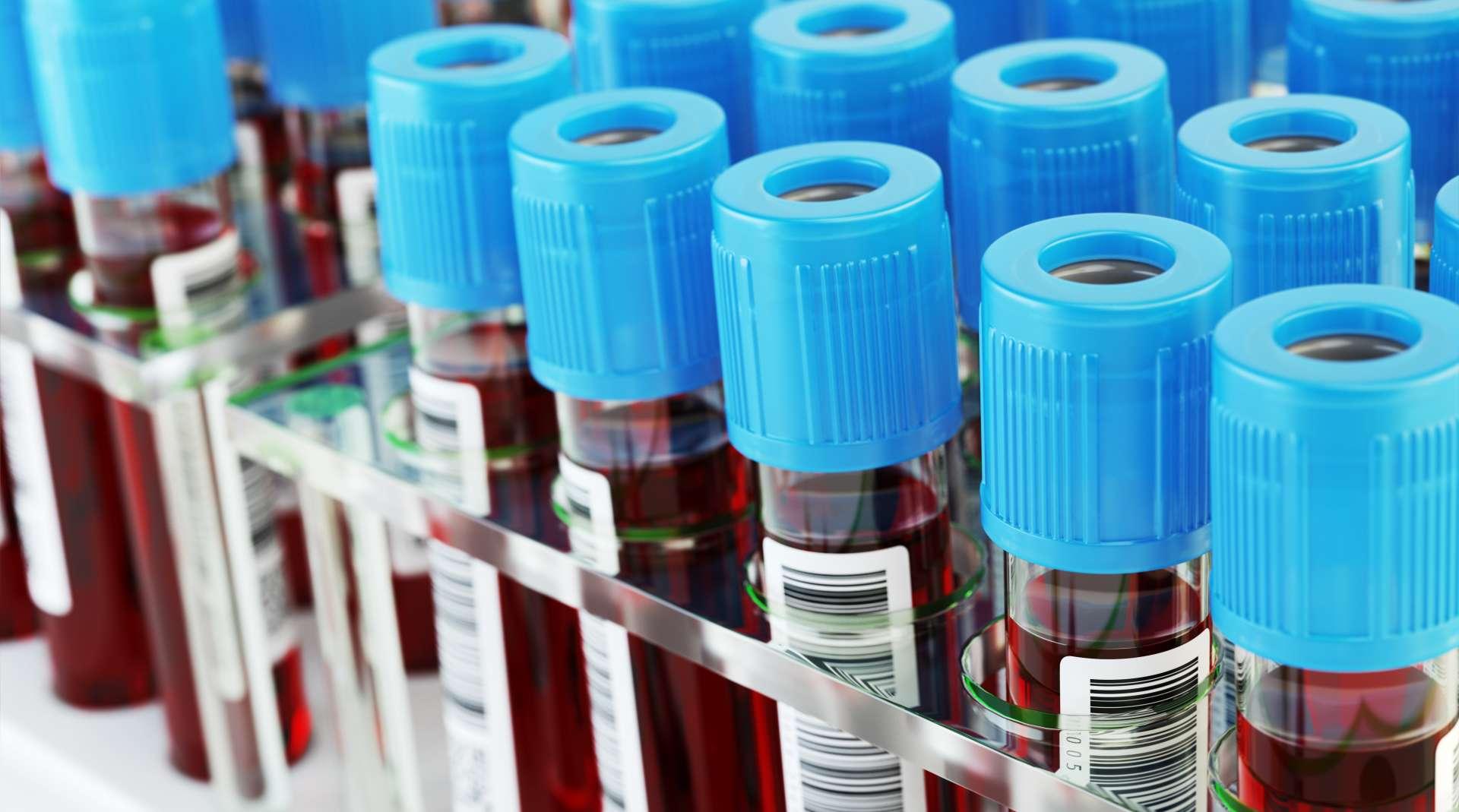 Blood test tubes. Blood samples in a rack. 3d illustration